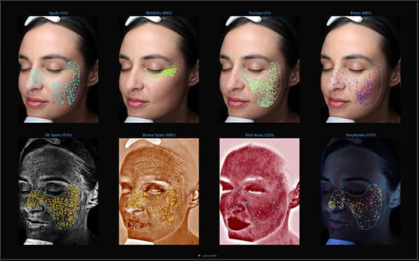 3D skin analysis imaging